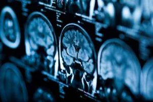 Hpe Storage Ge Healthcare Blog