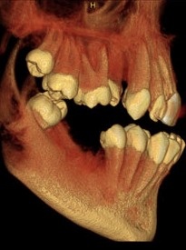 prexion_adds_archiving_system_for_xrays