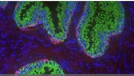 institute_of_cancer_research_sgi